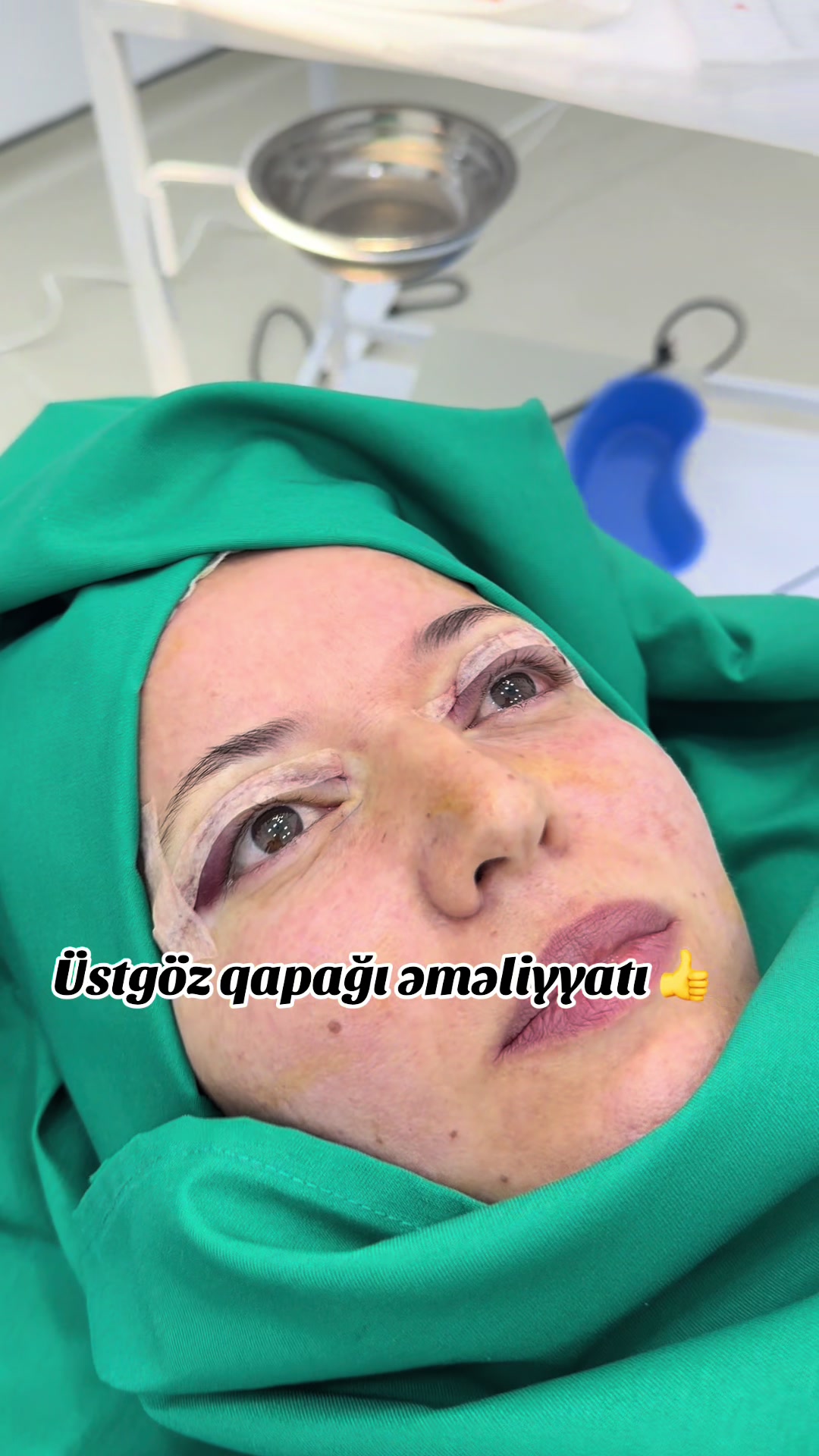 @Dr.ataxanli