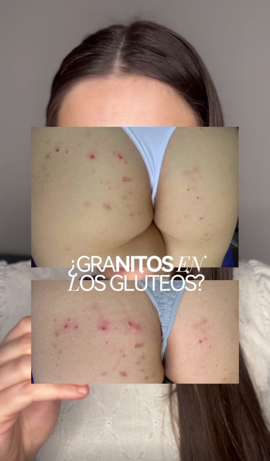 @Belén Estévez