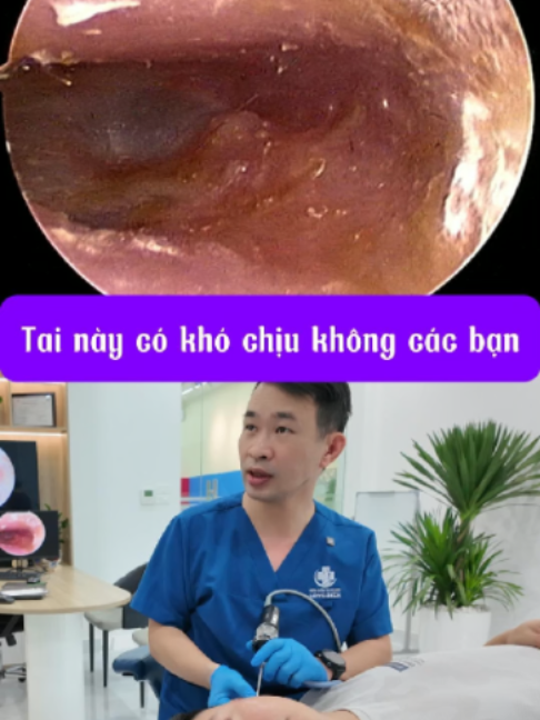 @Bs Hiệu Tai Mũi Họng Long Biên