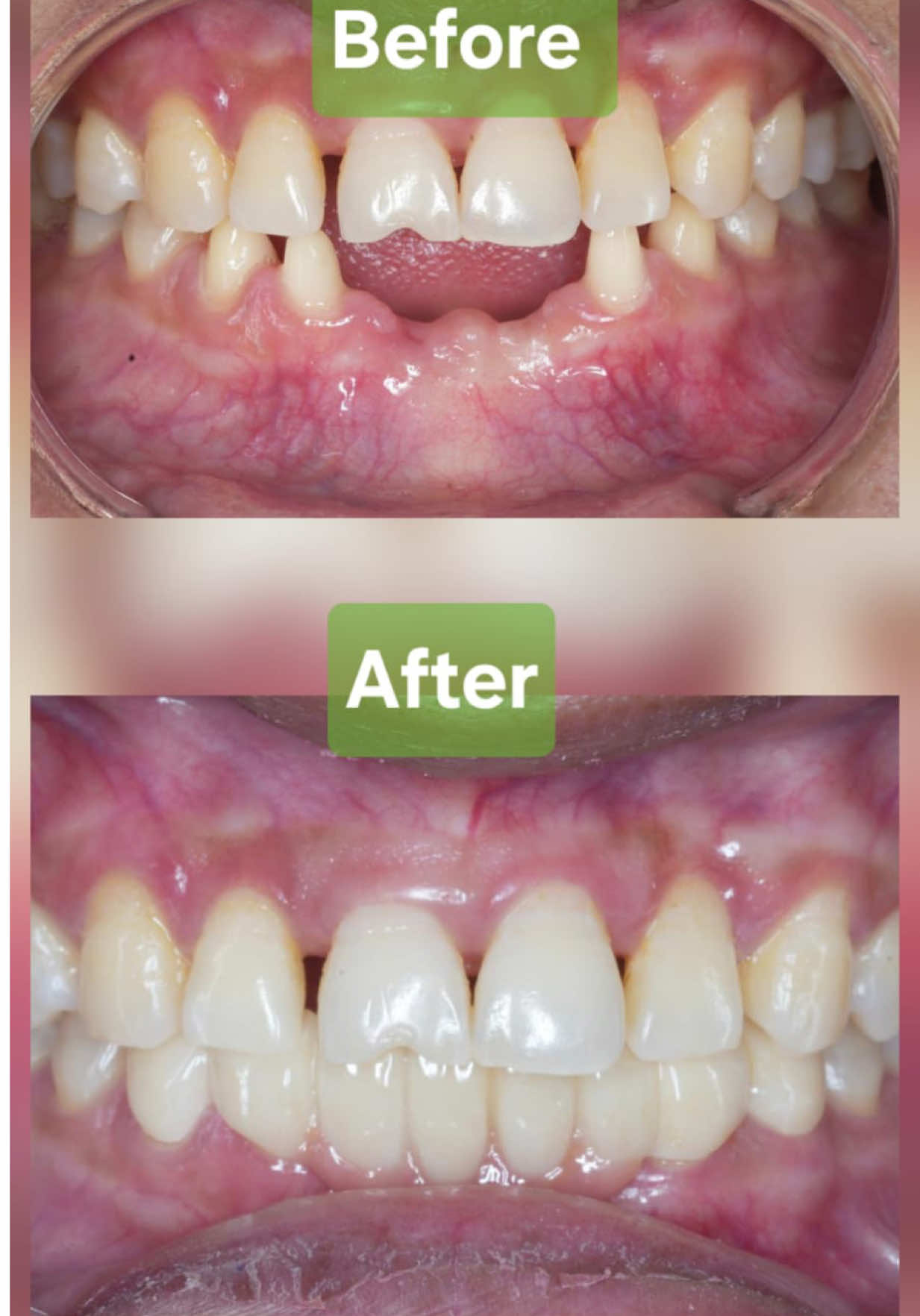@Smile Engineer Dr Bidhan