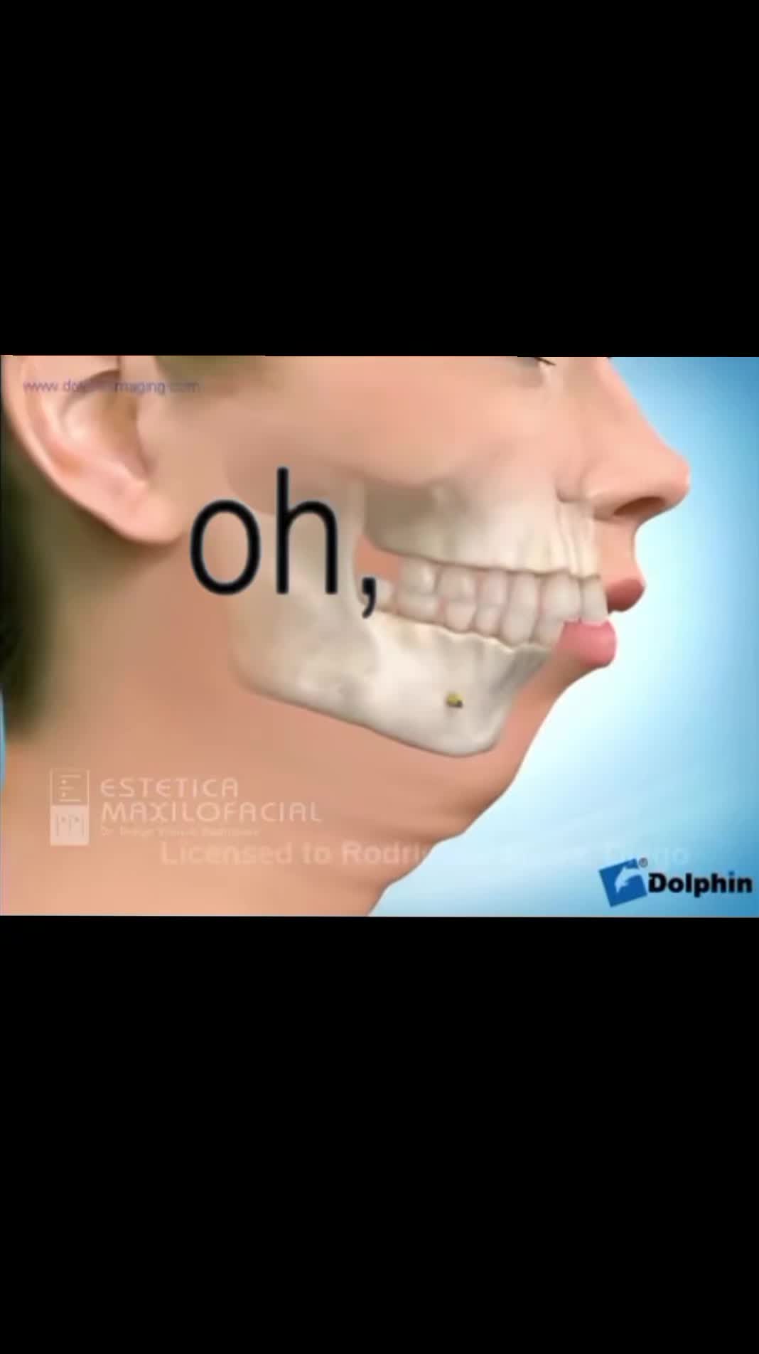 @l😂l