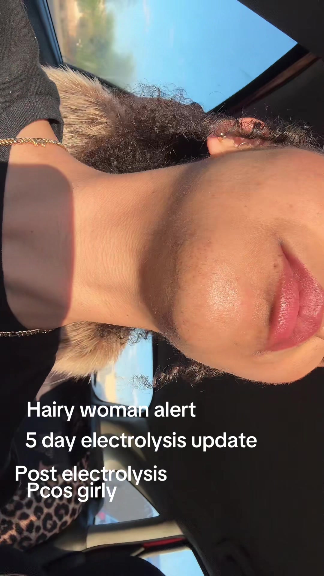 @JLaFlare