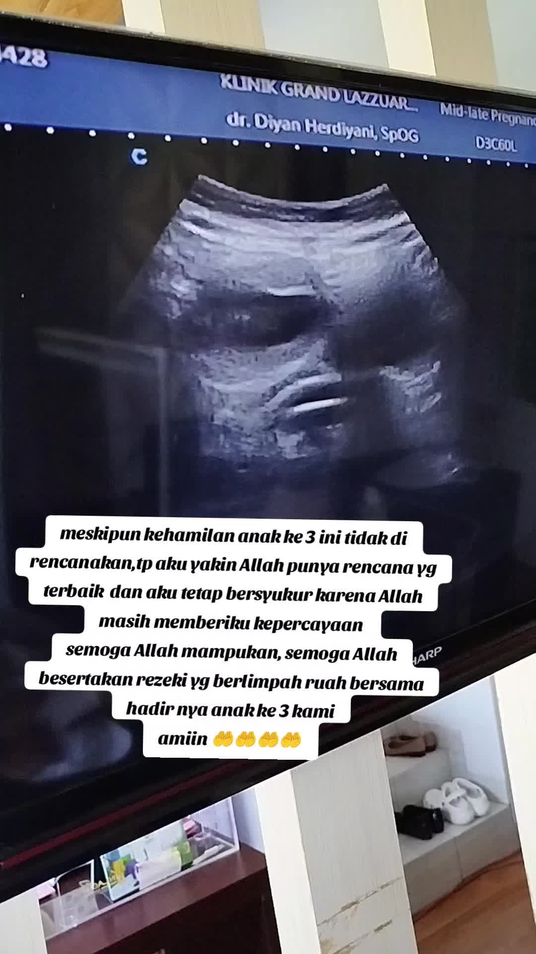@gita agistia