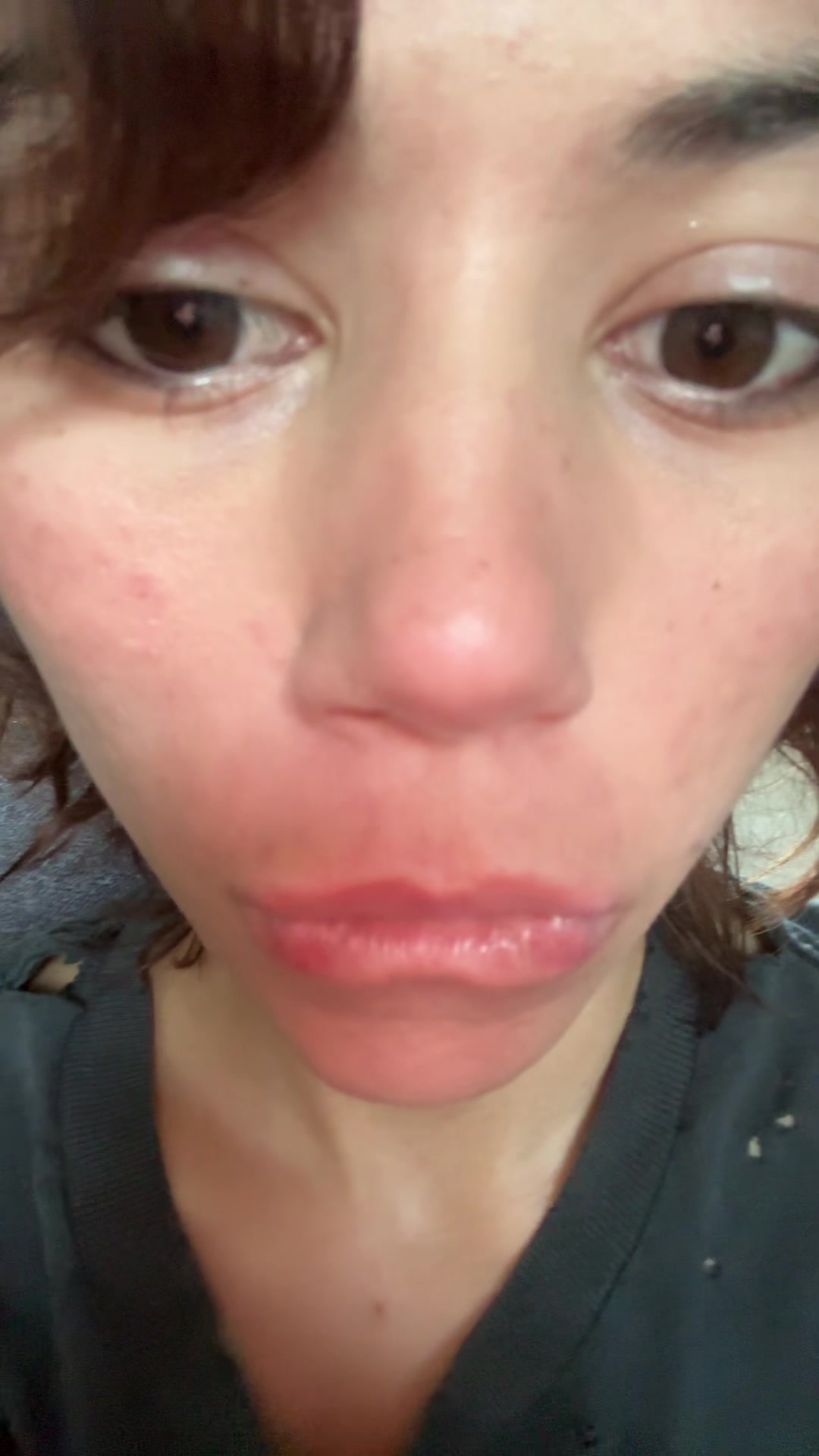 @skidknee