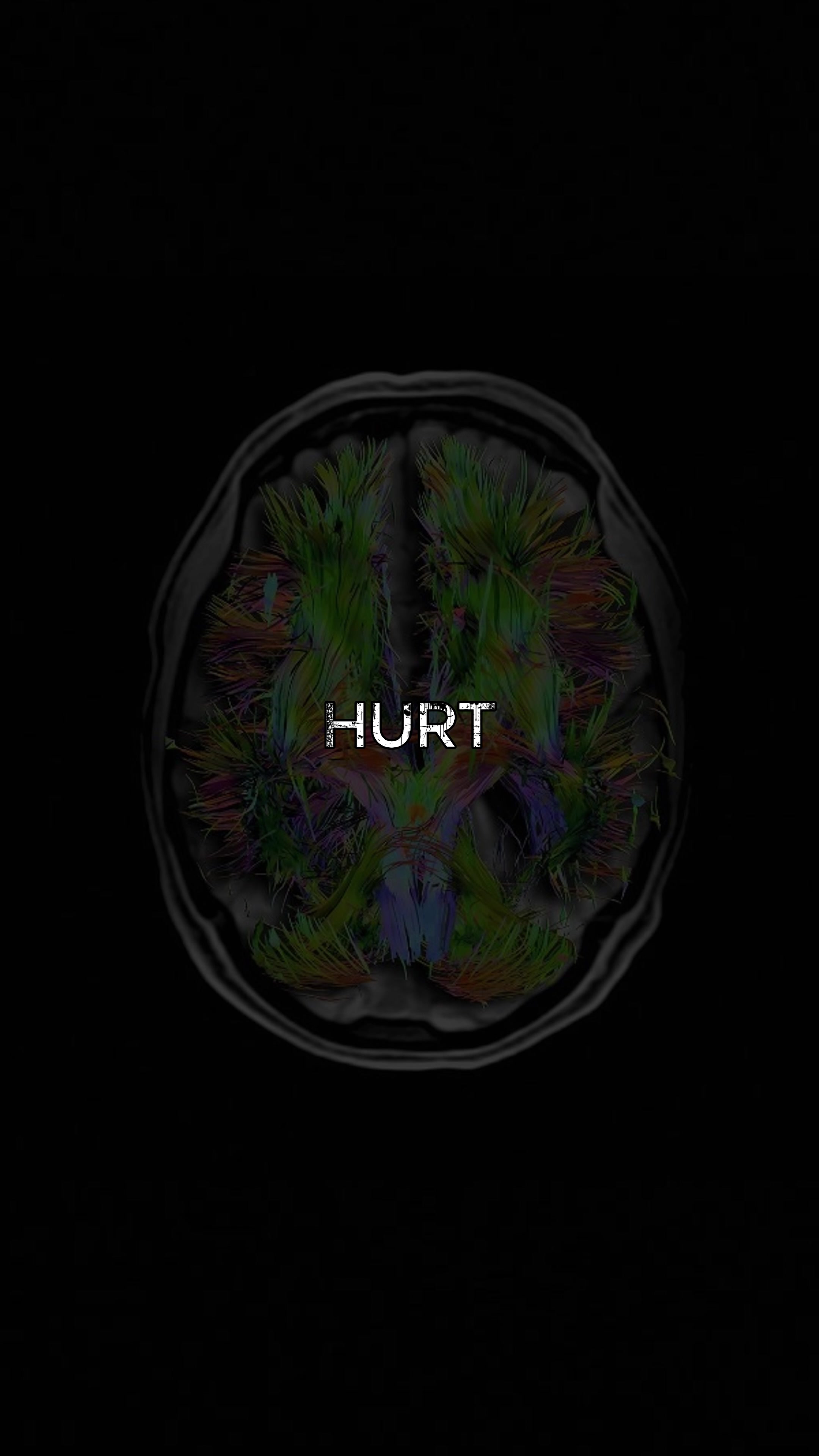 @NeuroWhisper