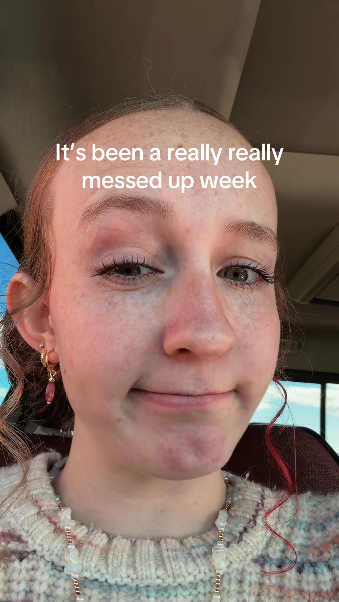 @Skyleigh