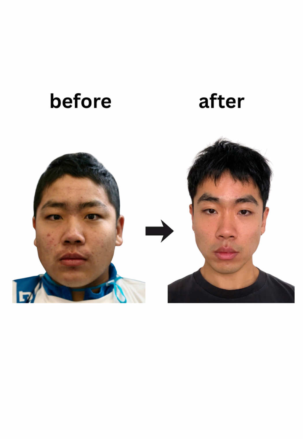 @Timo