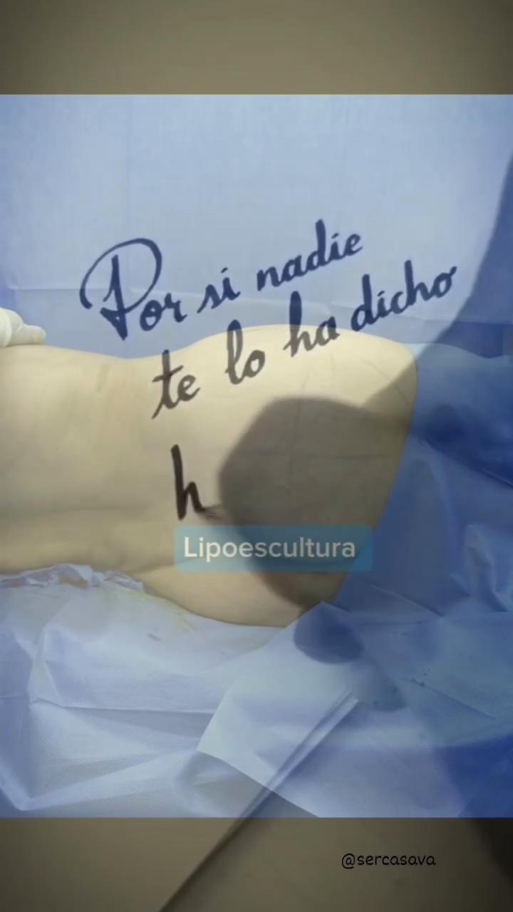 @David Alcivar
