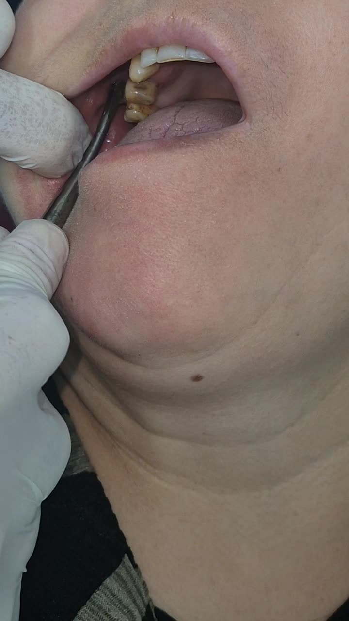 @RuslanDoc