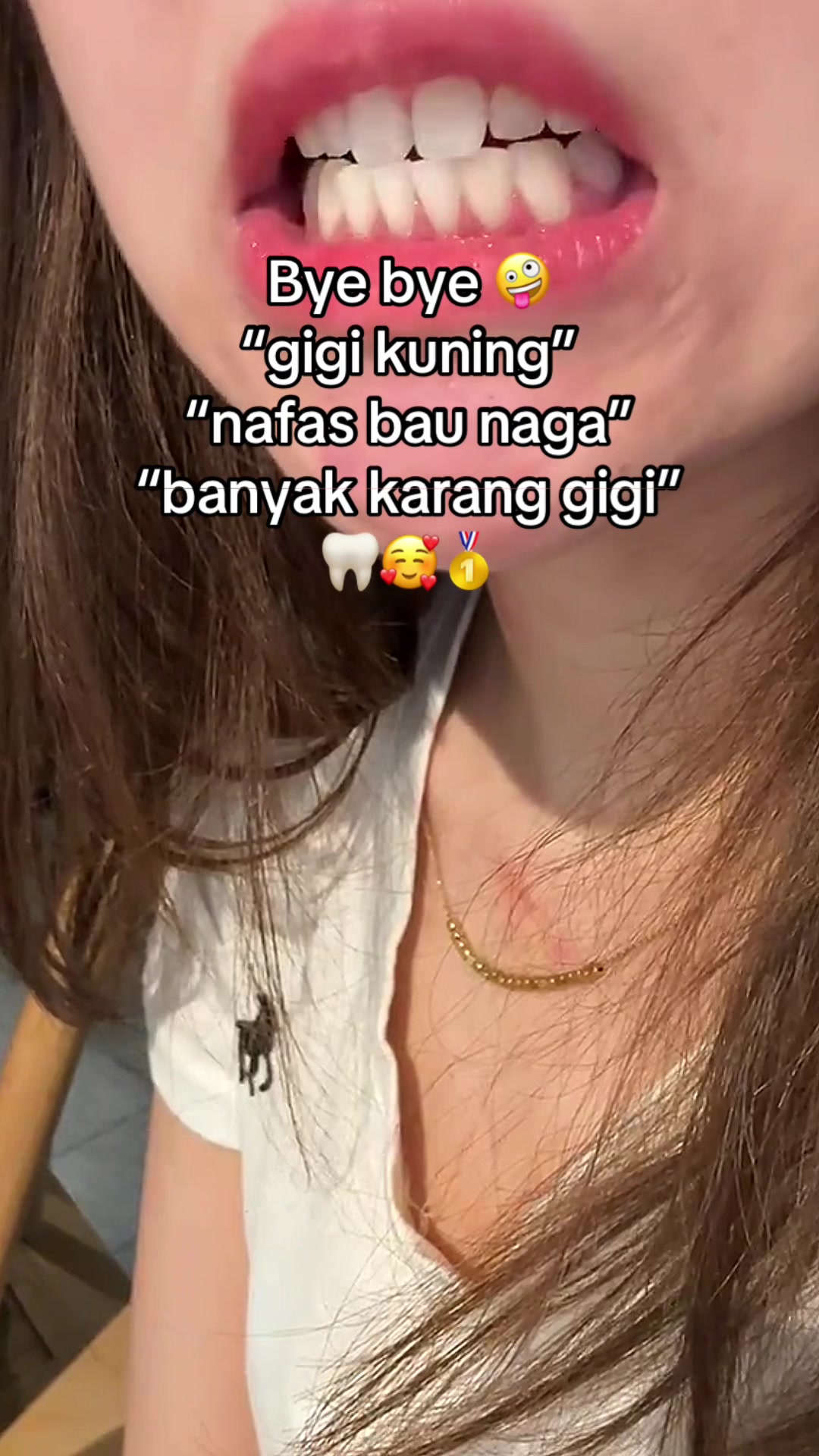 @Gigi Putih Berkilau🦷✨