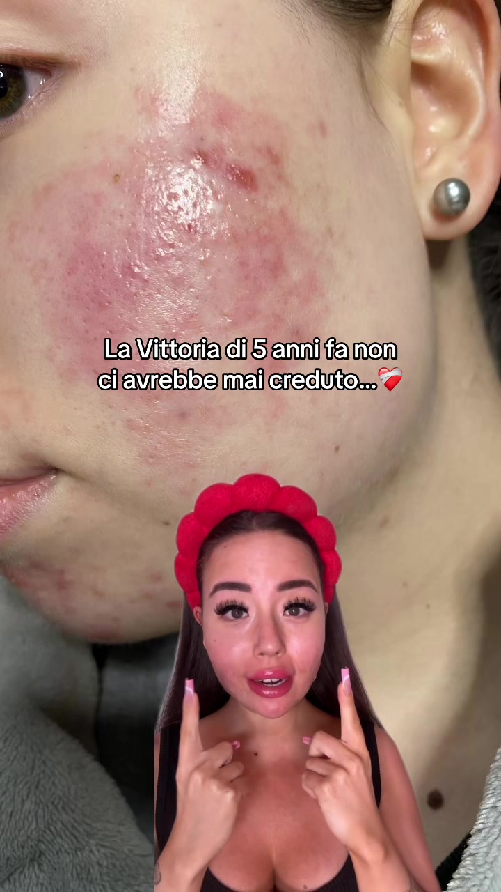 @Vittoria Benfenati