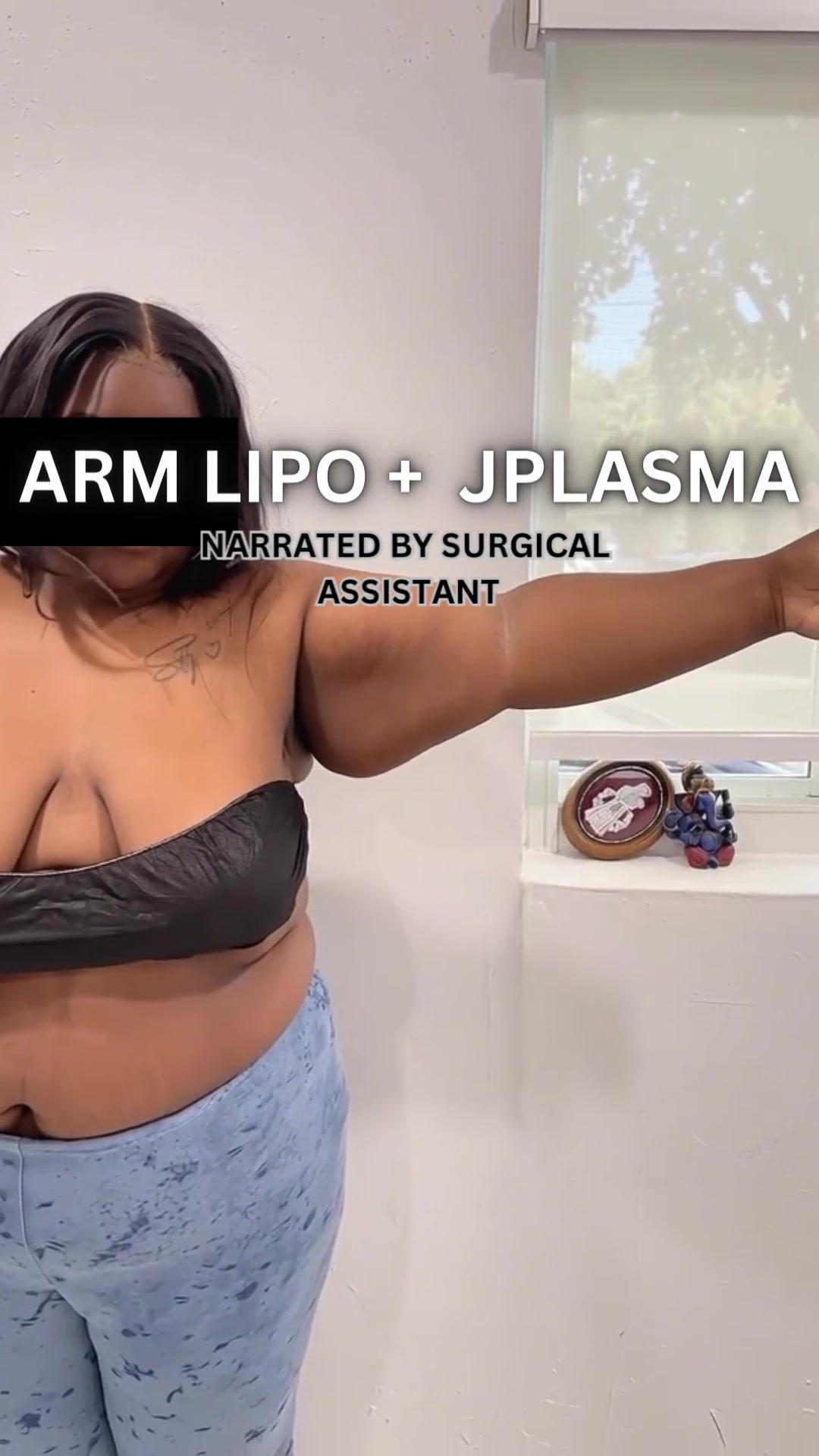 @BioAesthetic305