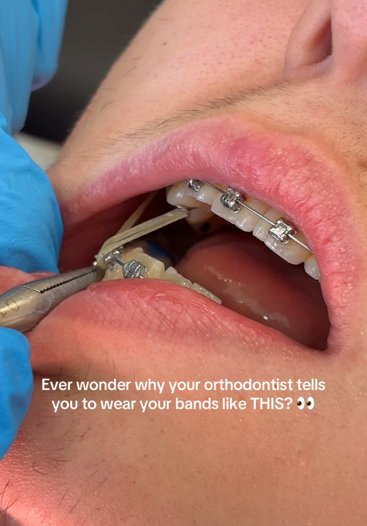 @Woodland Hills Orthodontist