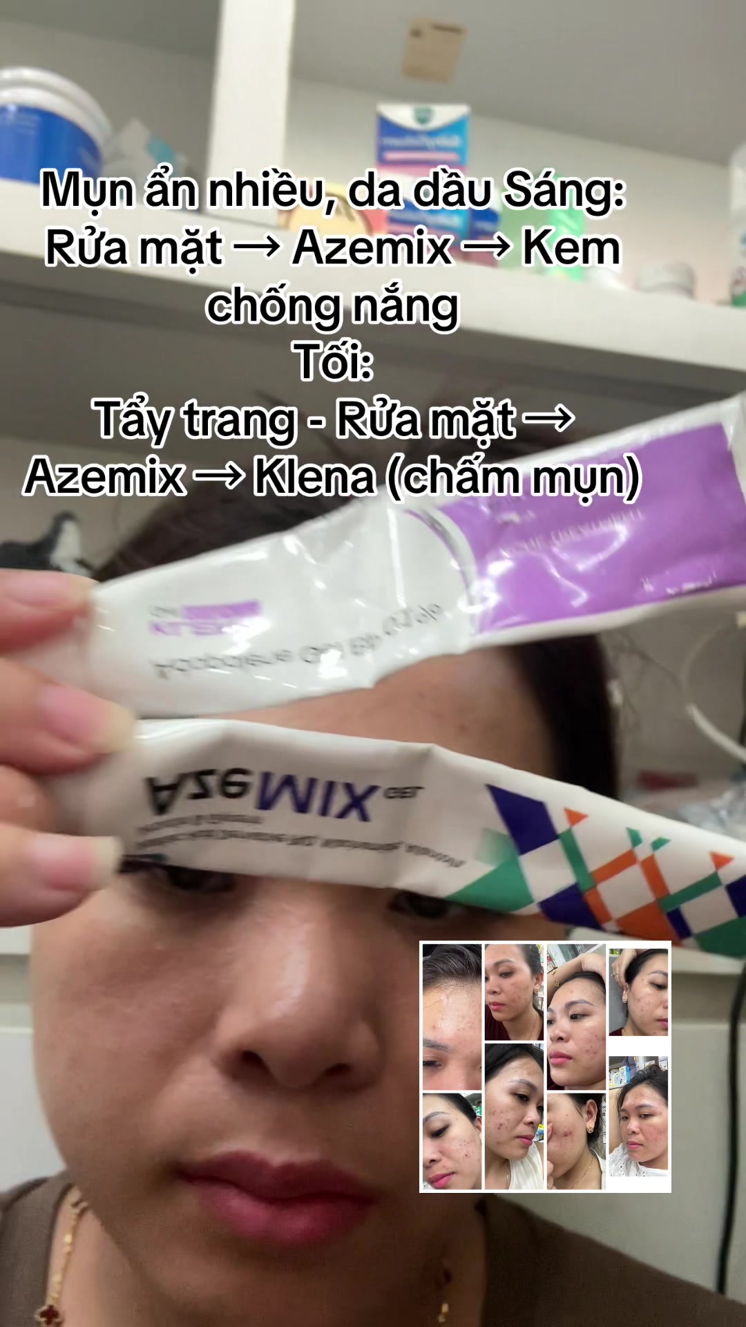 @Hoa Acne Skincare🌷