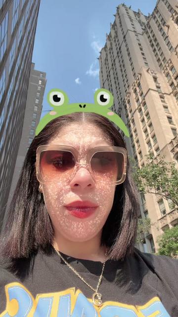 @🐸LARANA🐸