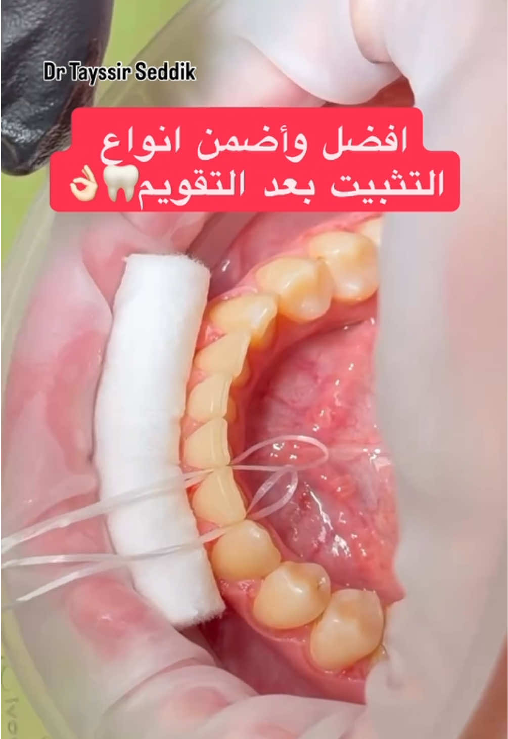 @Dr Tayssir Seddik