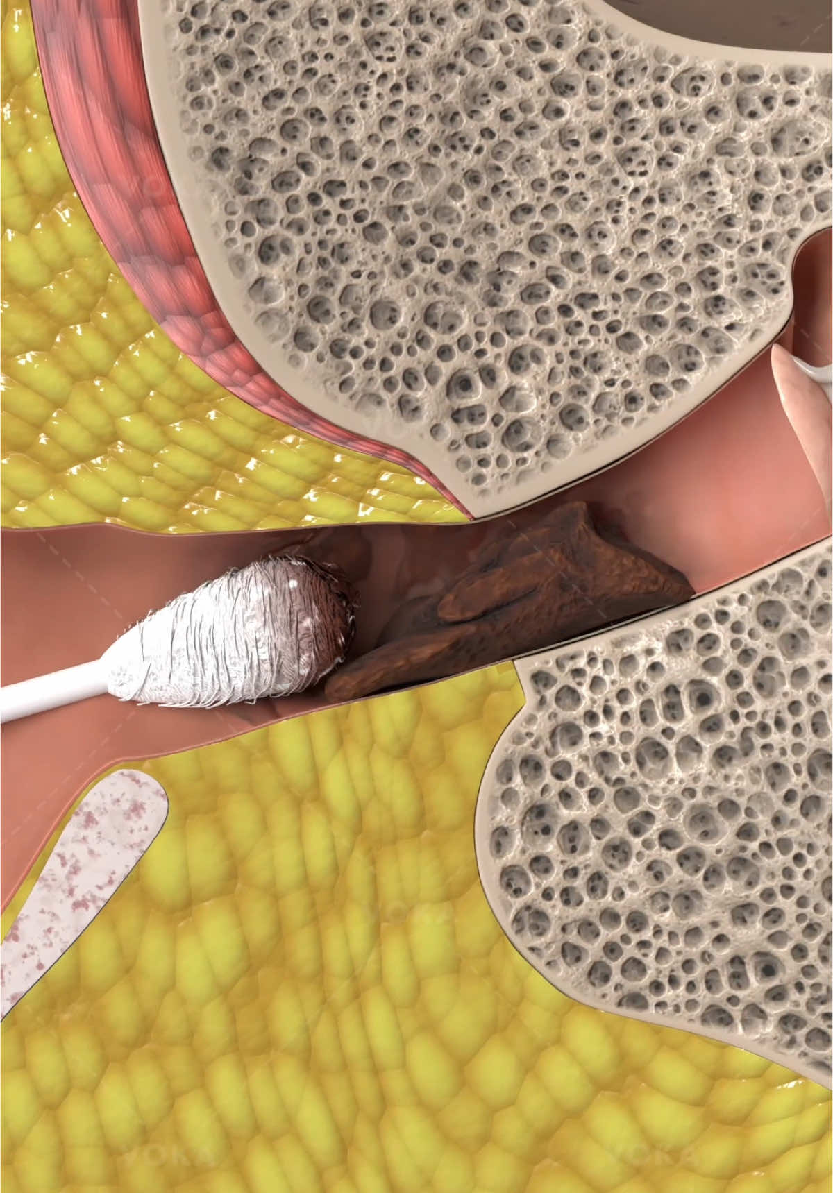 @VOKA 3D Anatomy & Pathology