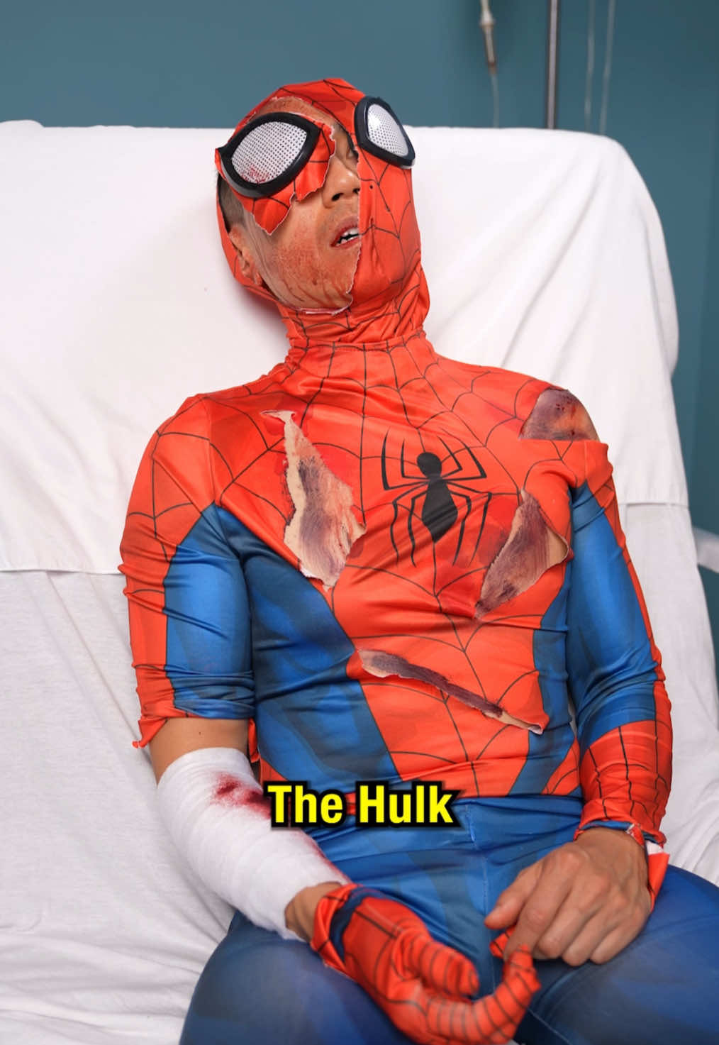 @Steveioe