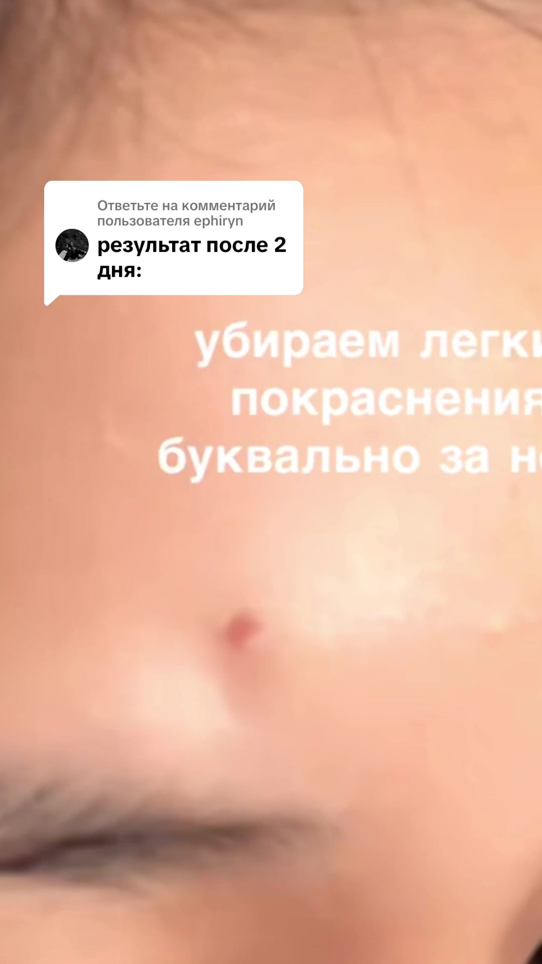 @ephiryn