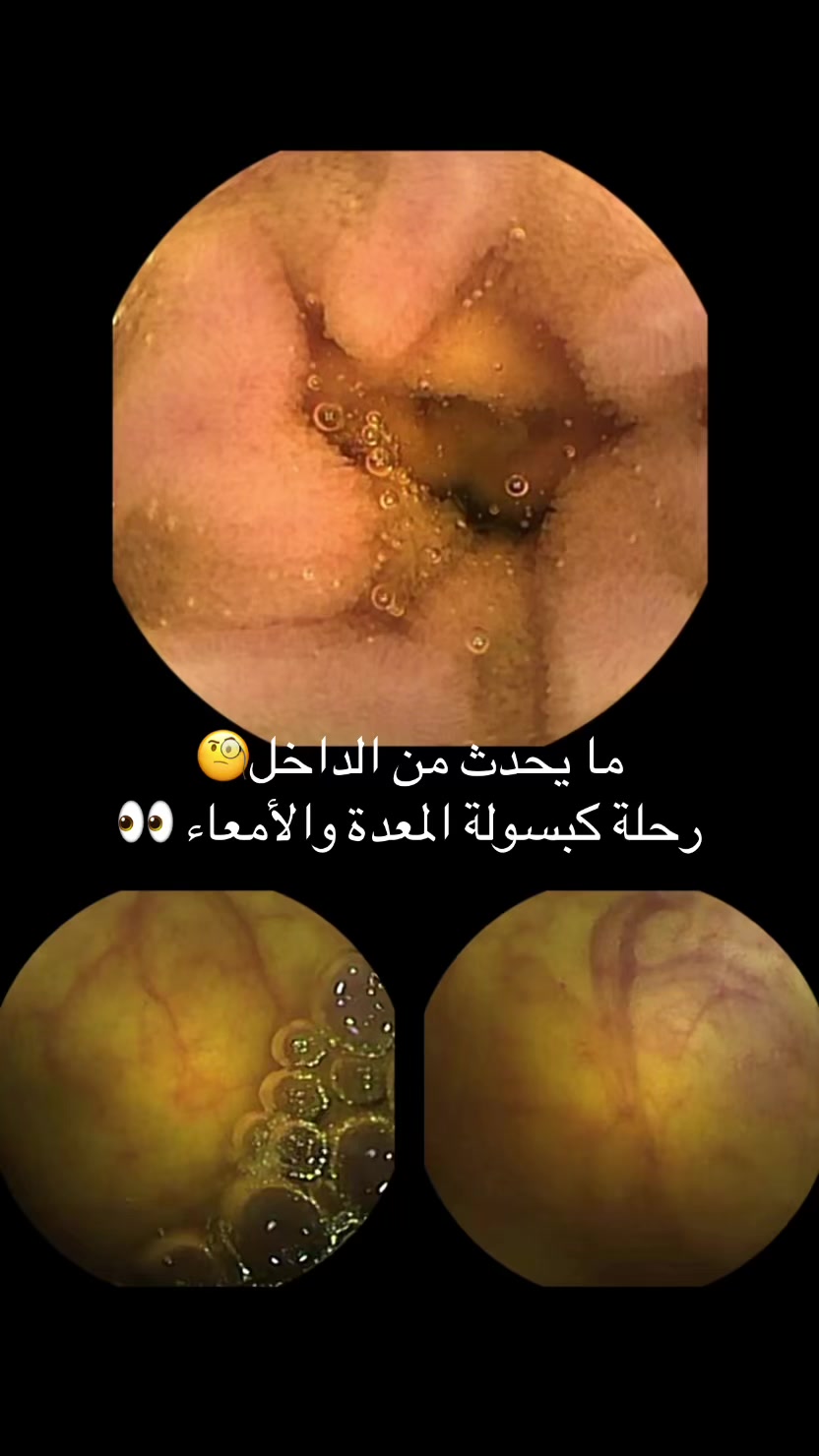 @مركز الجهاز الهضمي المتكامل