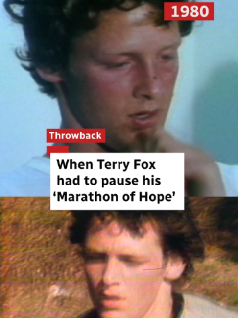 @CBC News