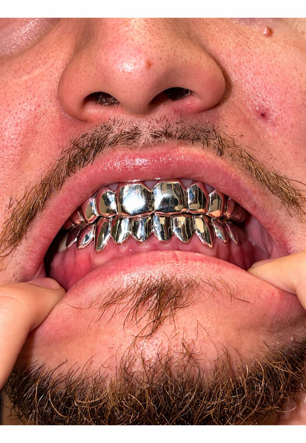 @AZ Grillz Plug