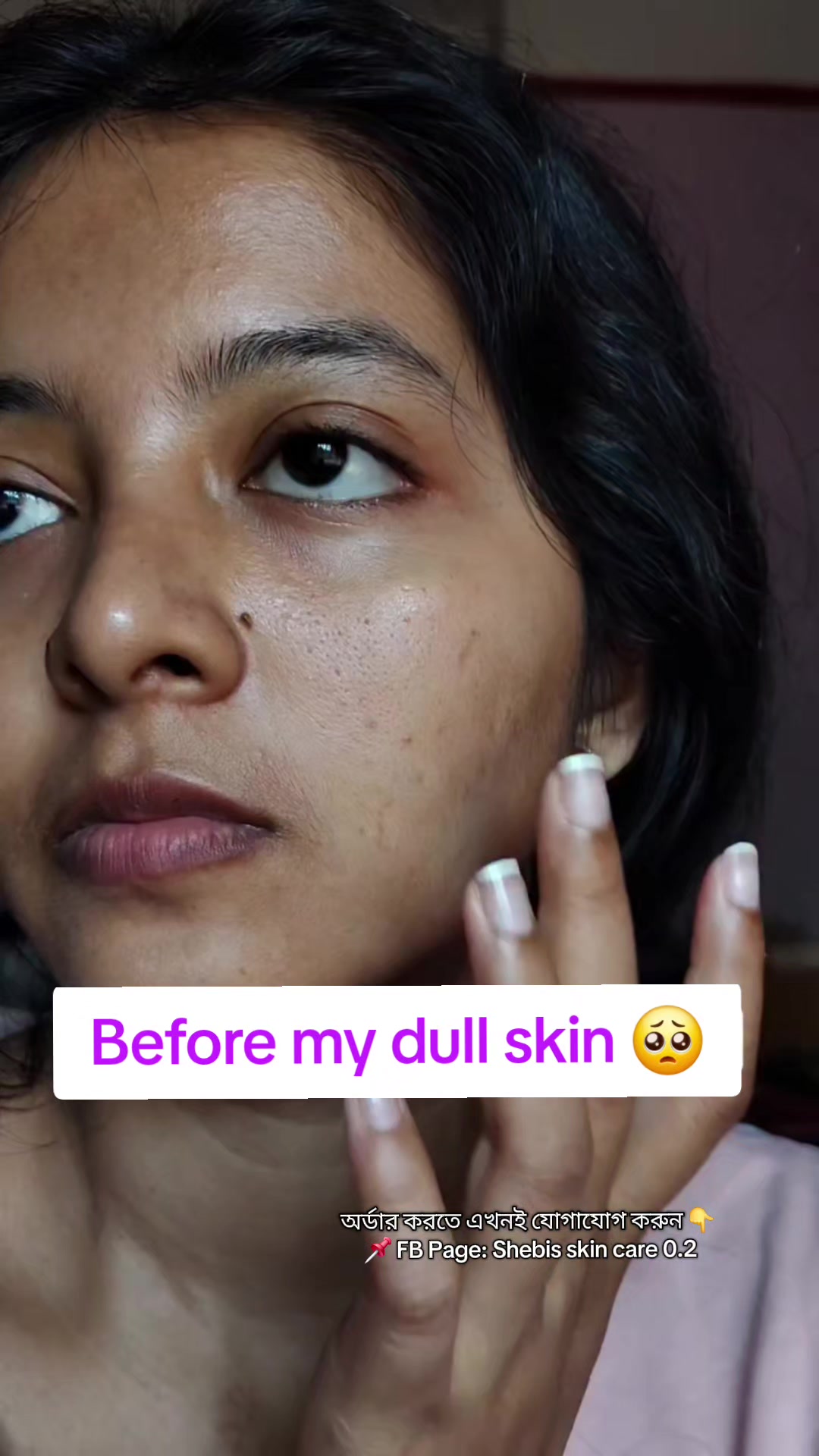 @Shebis skin care