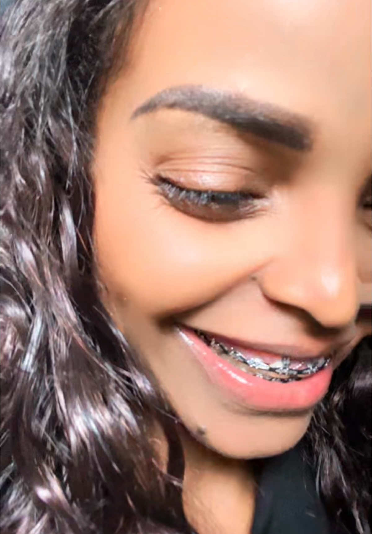 @emutiፍንጭቲያንስ🦷🦷😁