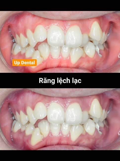@Nha khoa niềng răng Up Dental