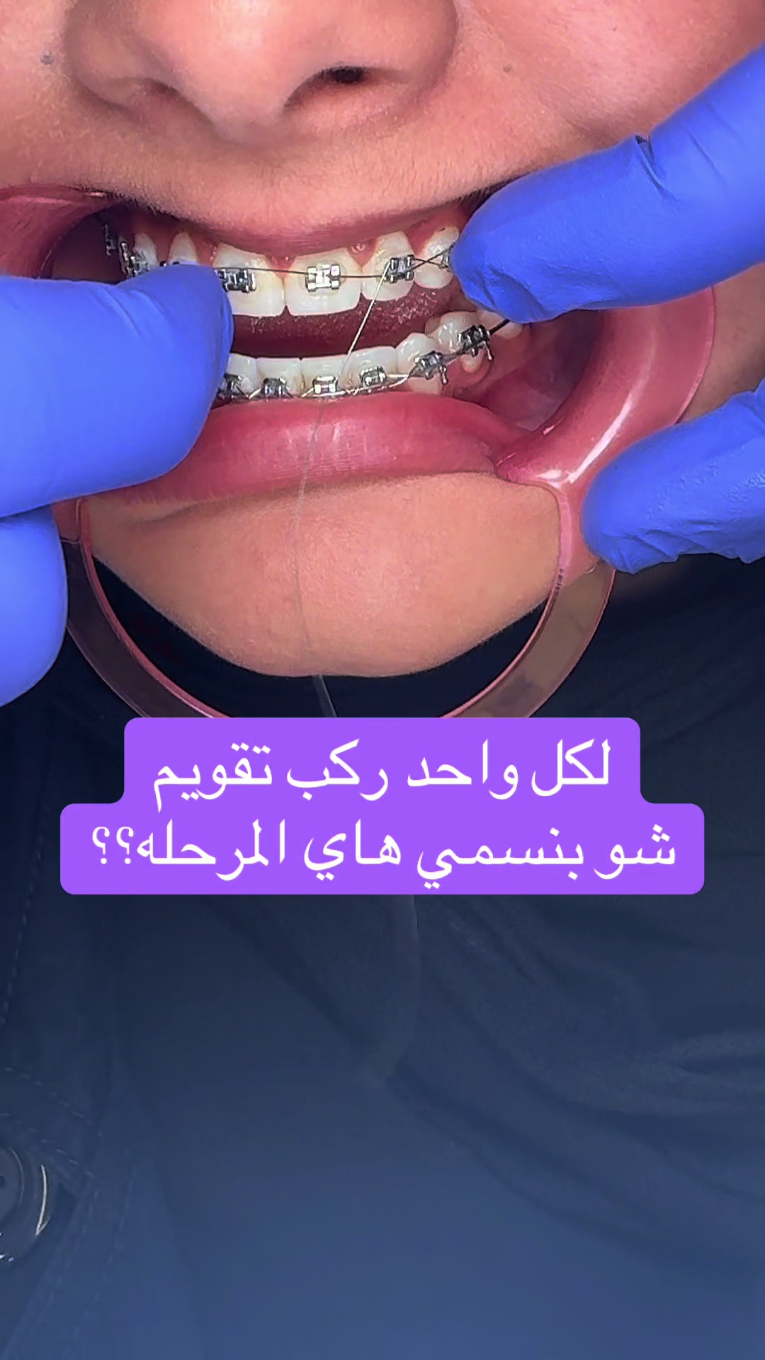 @DR.Tareq Bali