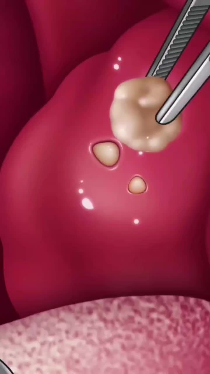 @Fernando Vieira