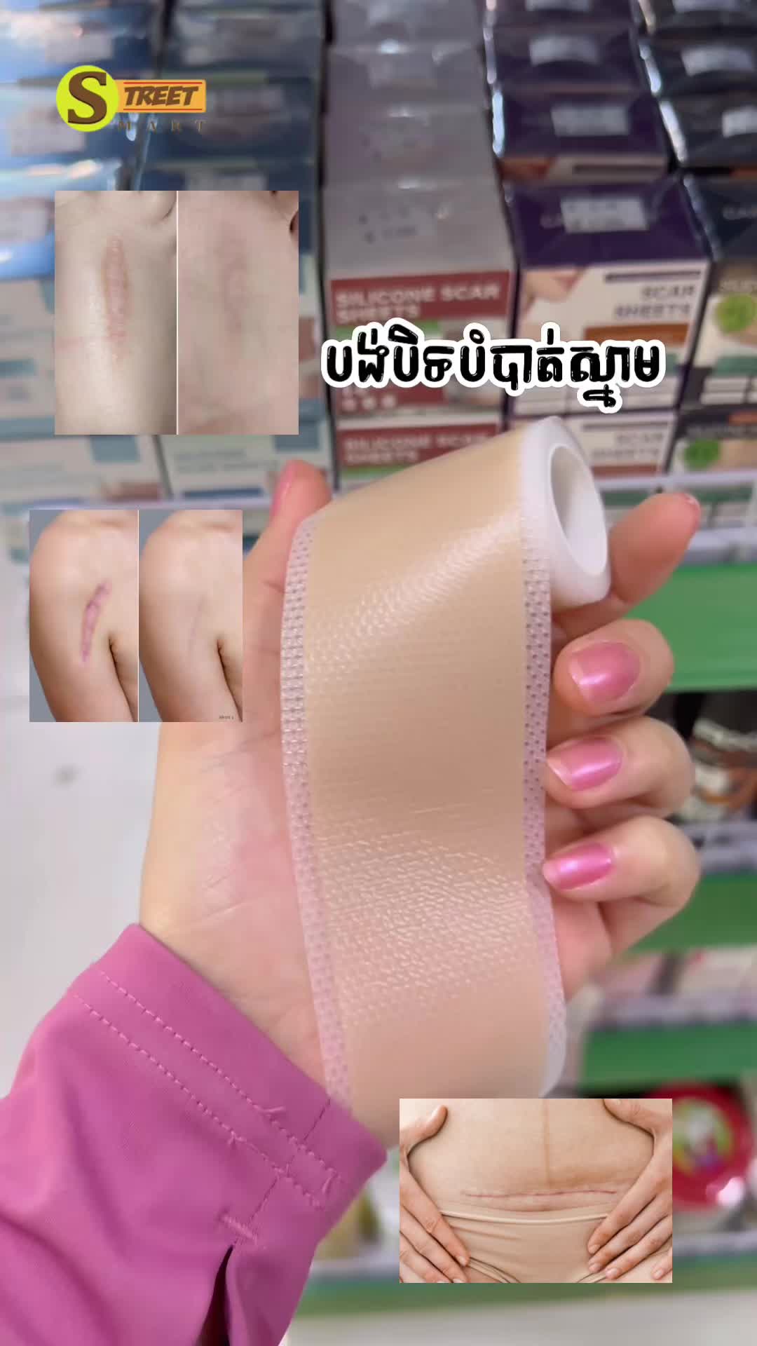 @Street Mart ស្រ្ទីតម៉ាត