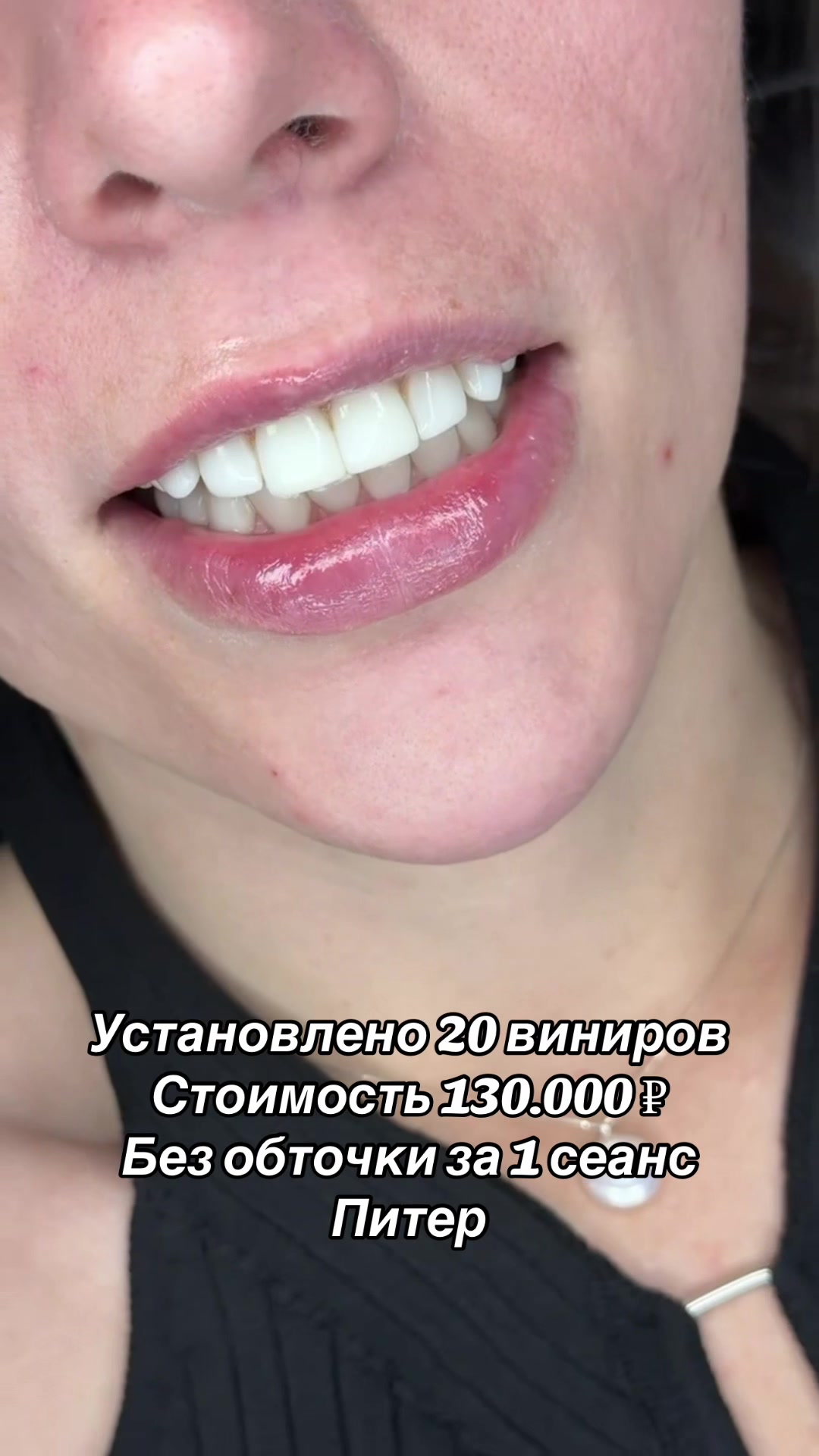 @Royal_smile_moscow