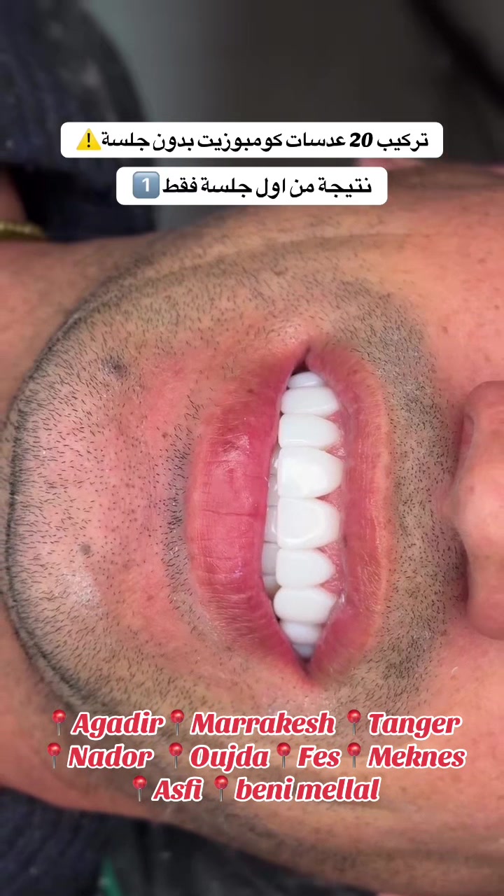 @brightsmileee1
