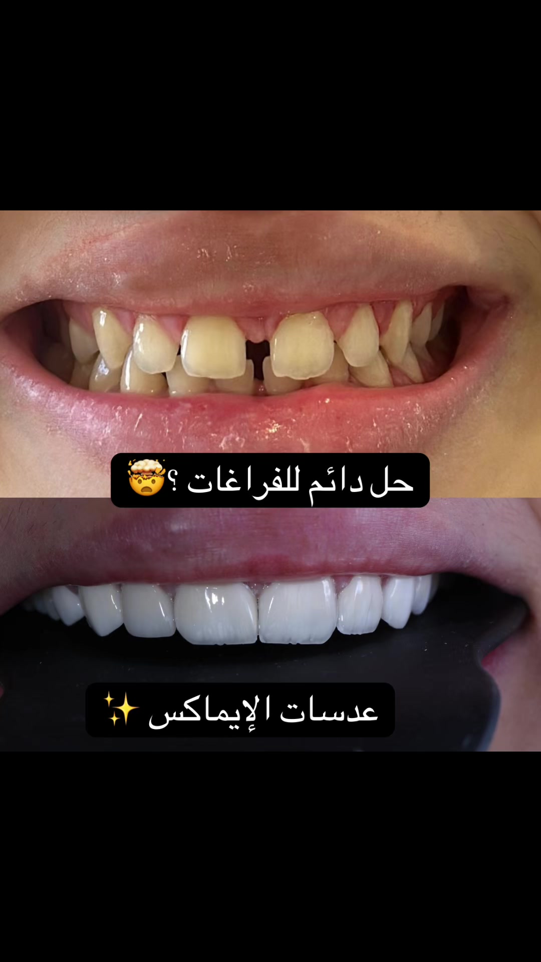 @Dr.ranaalsilani
