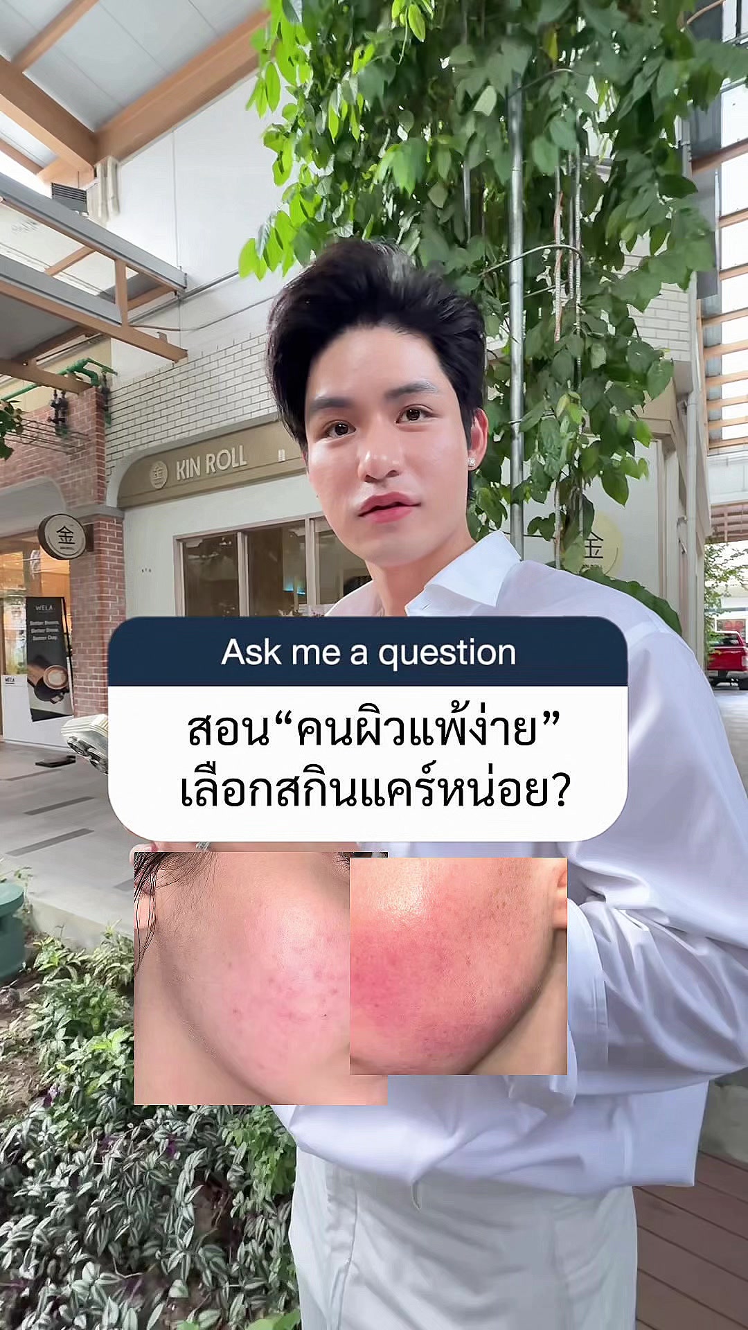 @หนูปอนด์ที่ชอบเลเซ่อร์