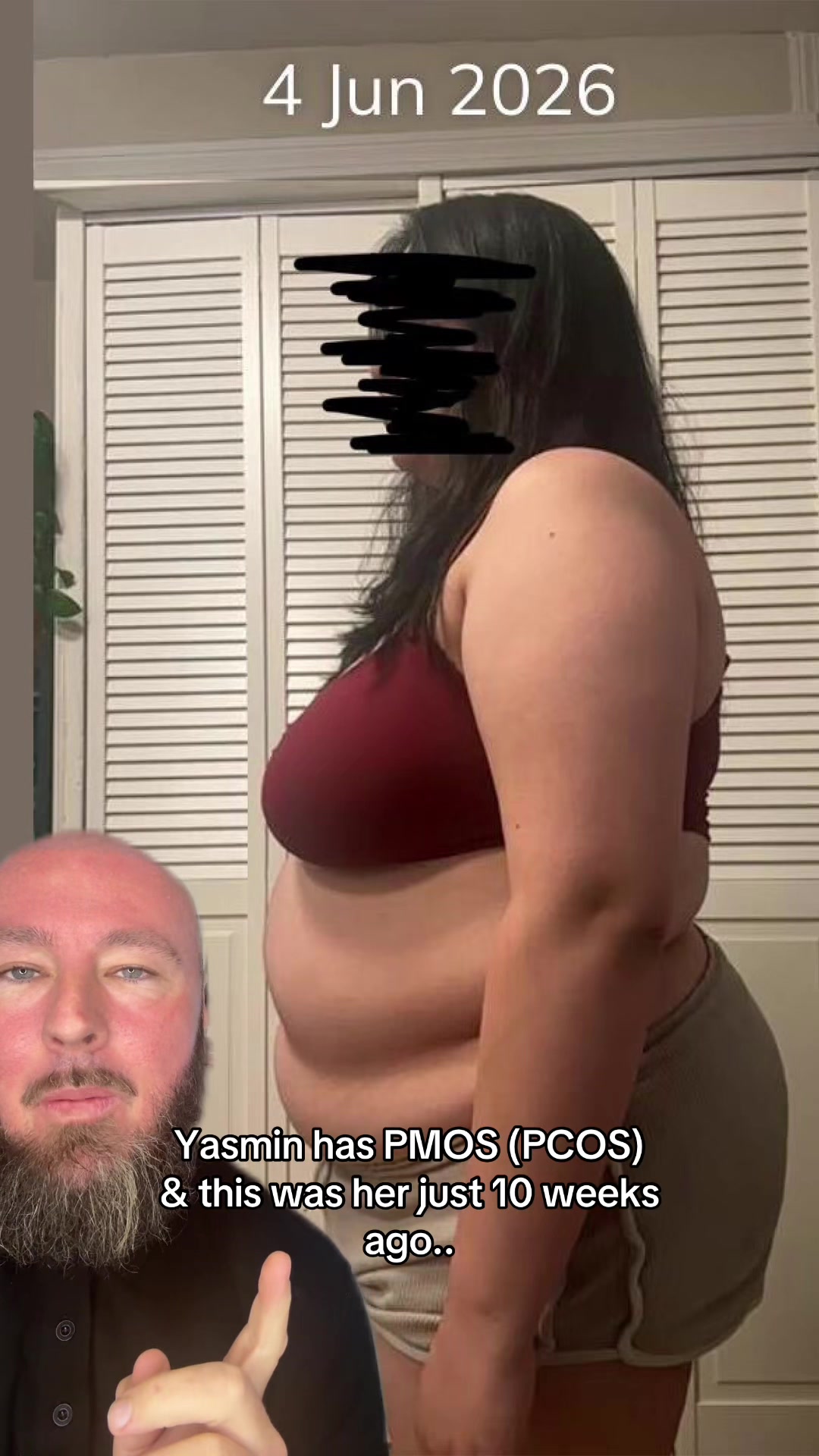 @Drew Baird | the PCOS mentor