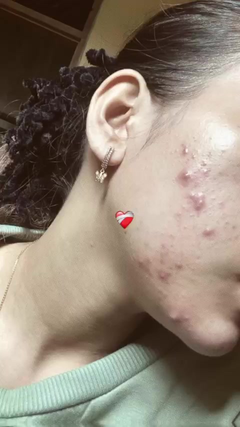 @hiiinielsaaa