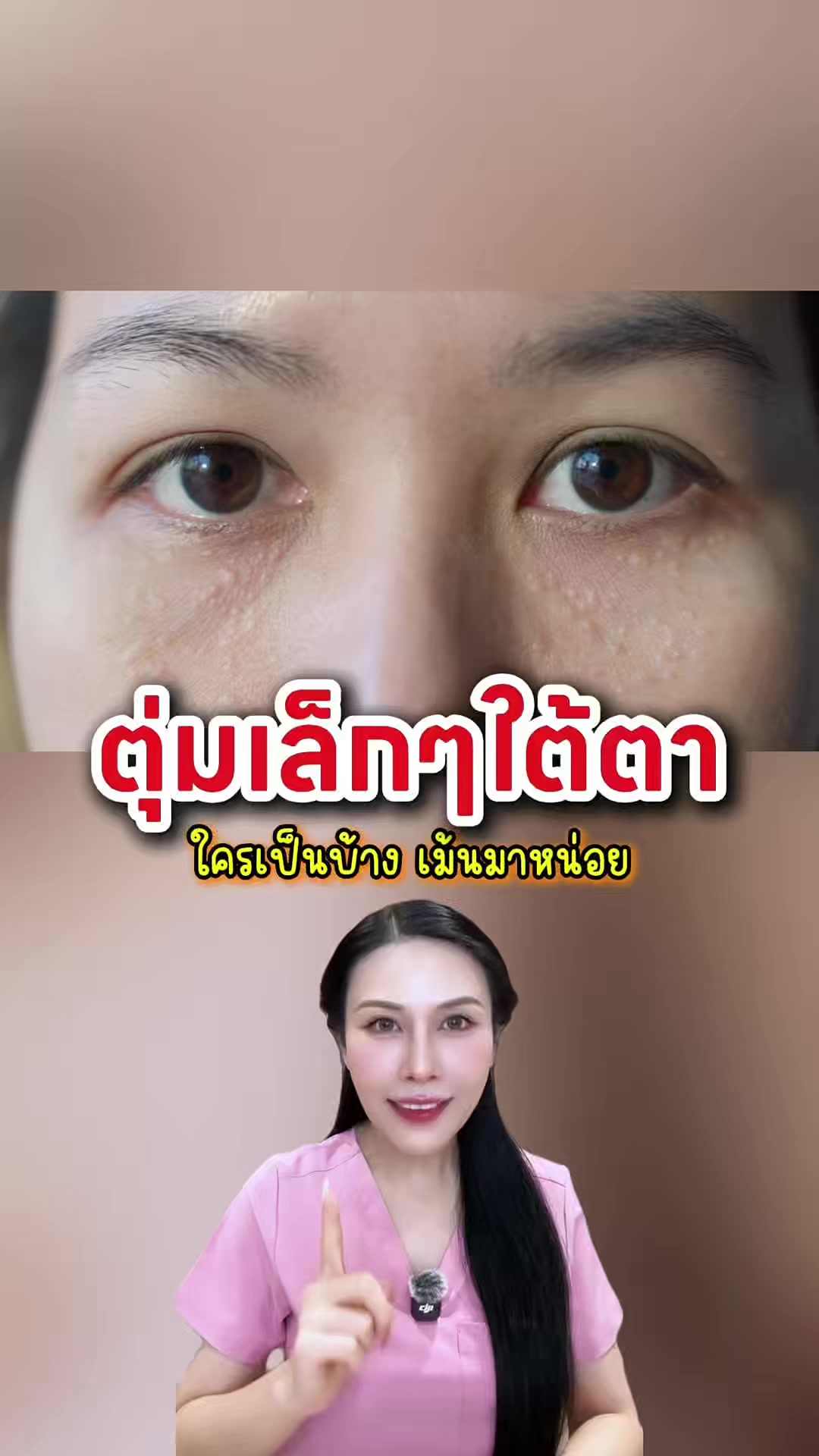 @พยาบาลอัญ
