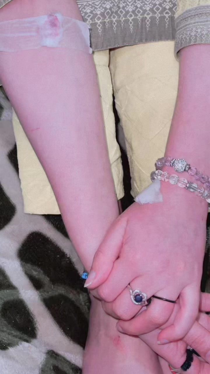 @Dimple