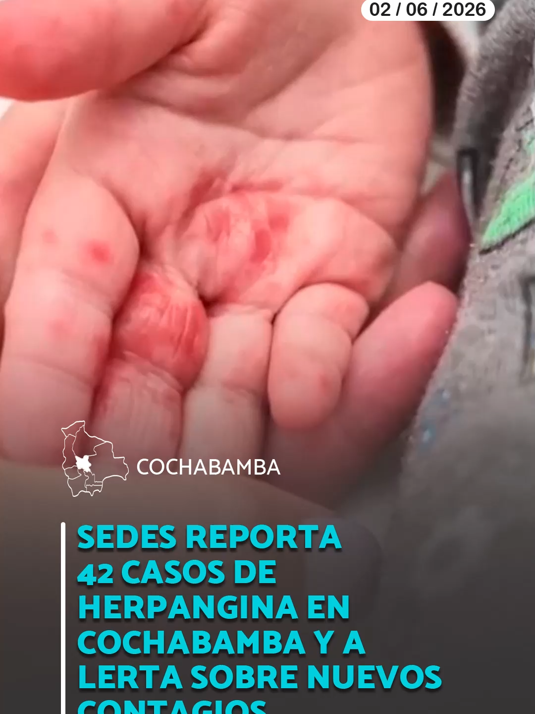 @Conexi&oacute;nbol