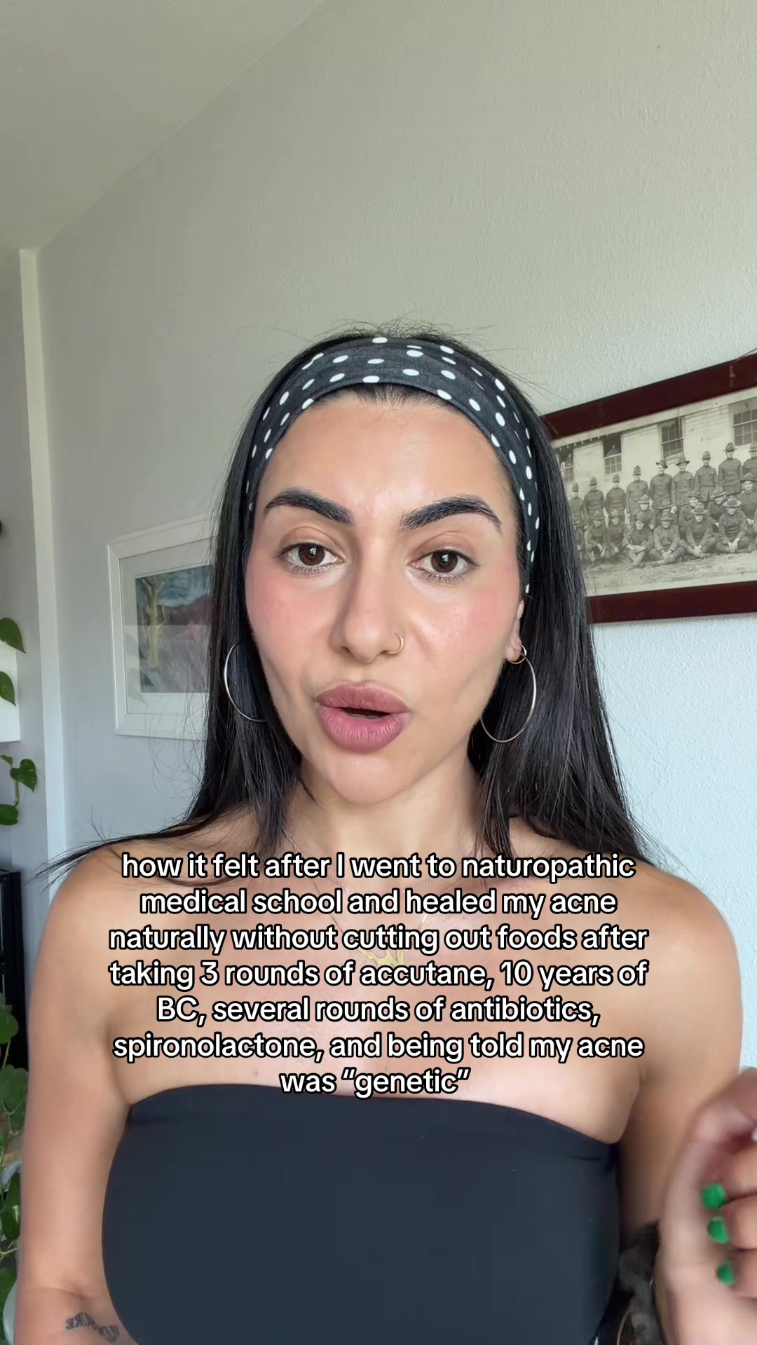 @Doctor Sheyda | Acne Expert