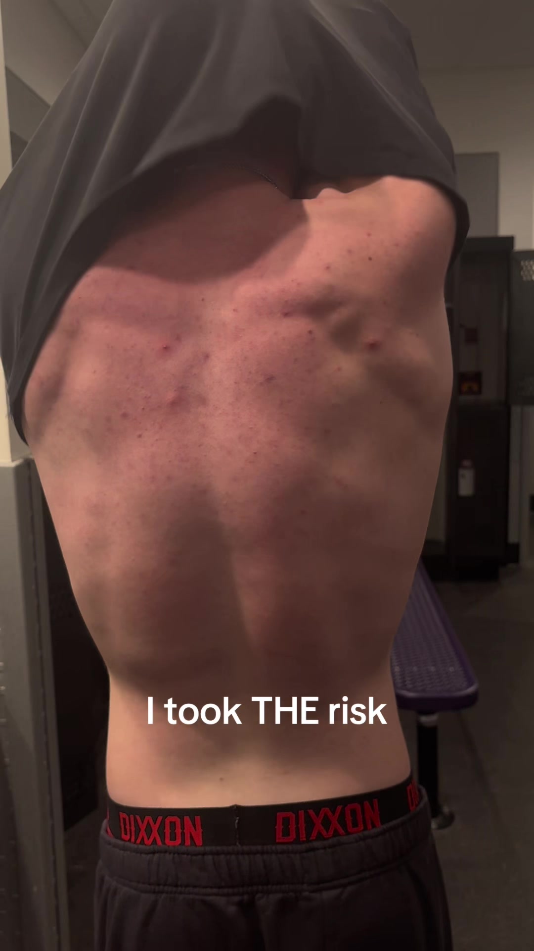 @evansinjecting