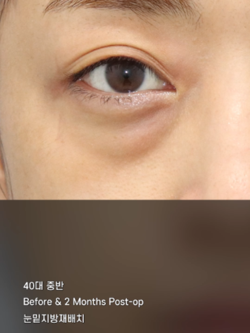 @다시피움성형외과 DASIPIUM タシピウム