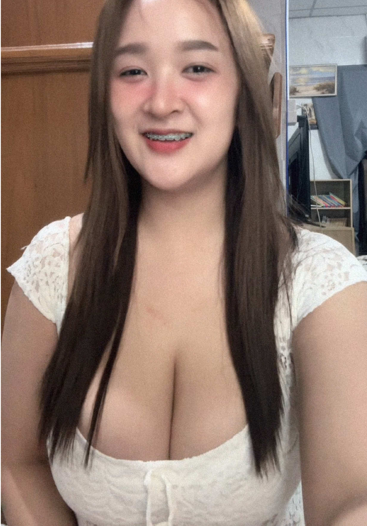@srnon_fern