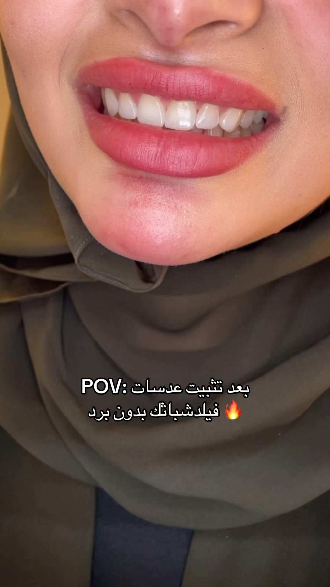 @Dr. Abrar Alhababi