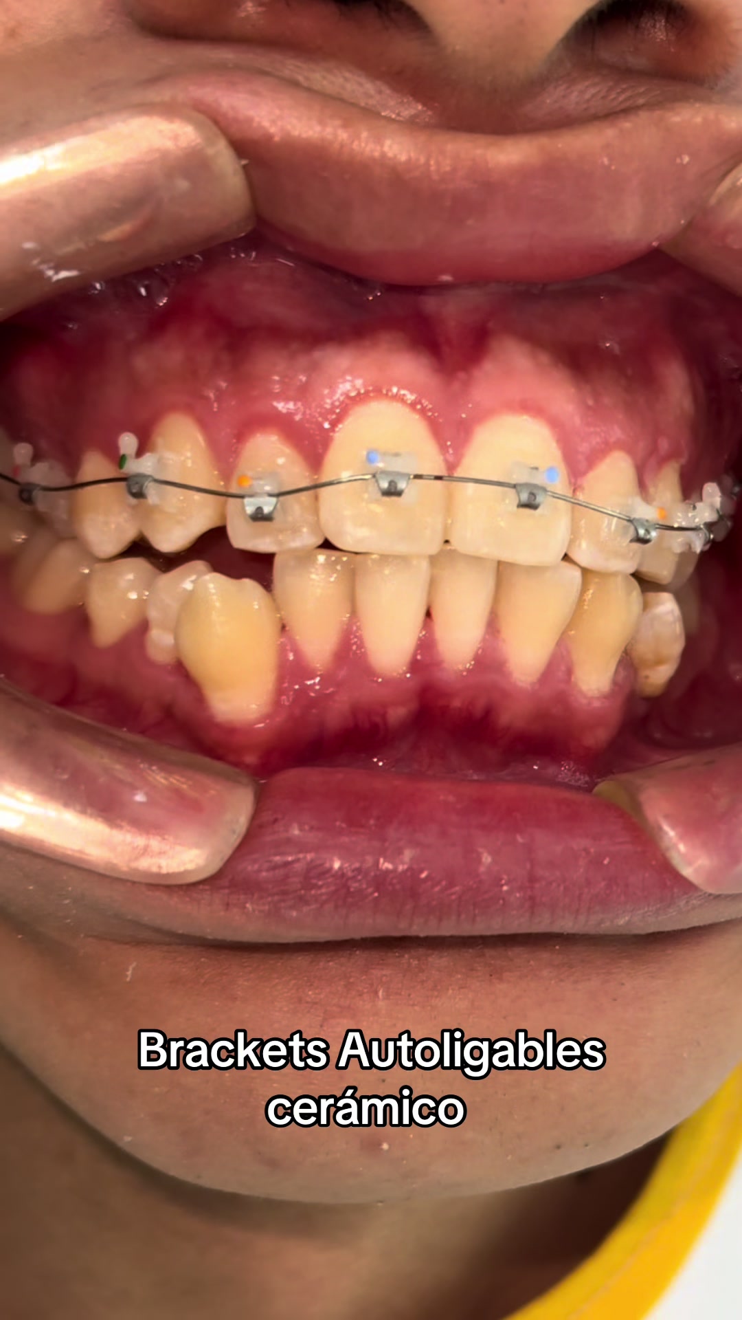 @Dr. Juan Perez | Ortodoncista