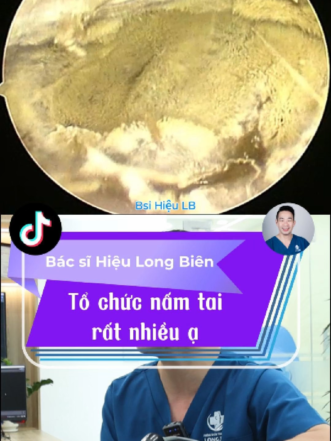 @Bs Hiệu Tai Mũi Họng Long Bi&ecirc;n