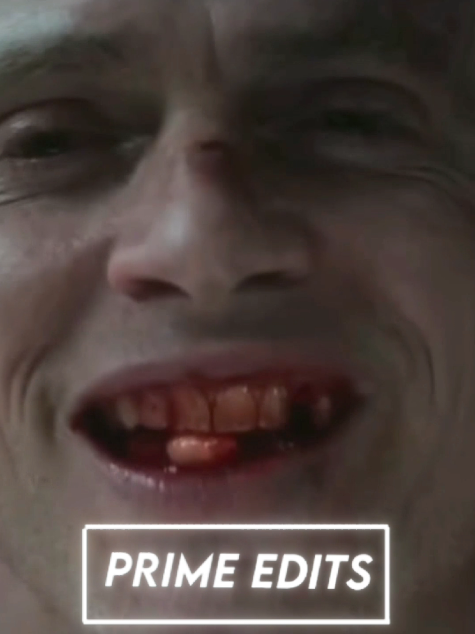 @๐ฃ๐ฅ๐๐ ๐ ๐๐๐๐ง๐ฆ