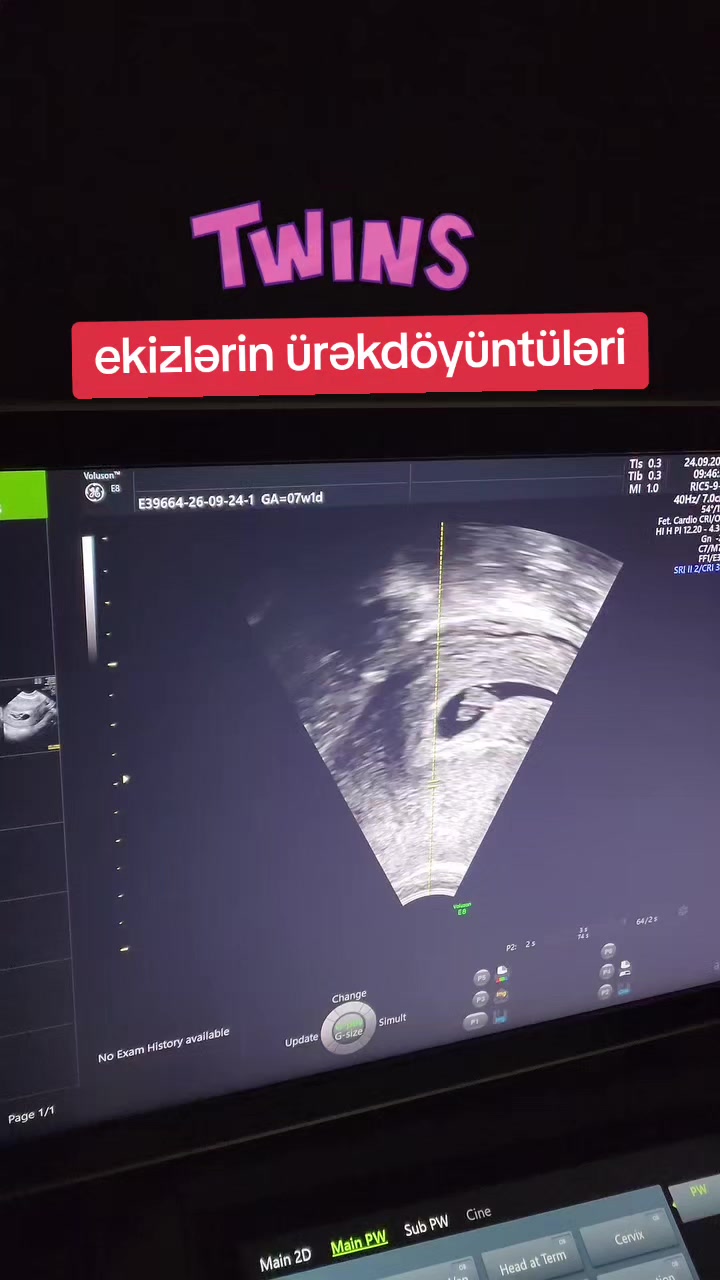 @Ginekoloq Esmira Hasanova